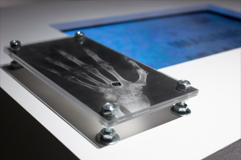Oráculo Imagen de radiografía de una mano, al lado una pantalla